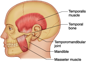 درد آرتریت تمپرومندیبولار (tempromandibular) و روش های مختلف درمان