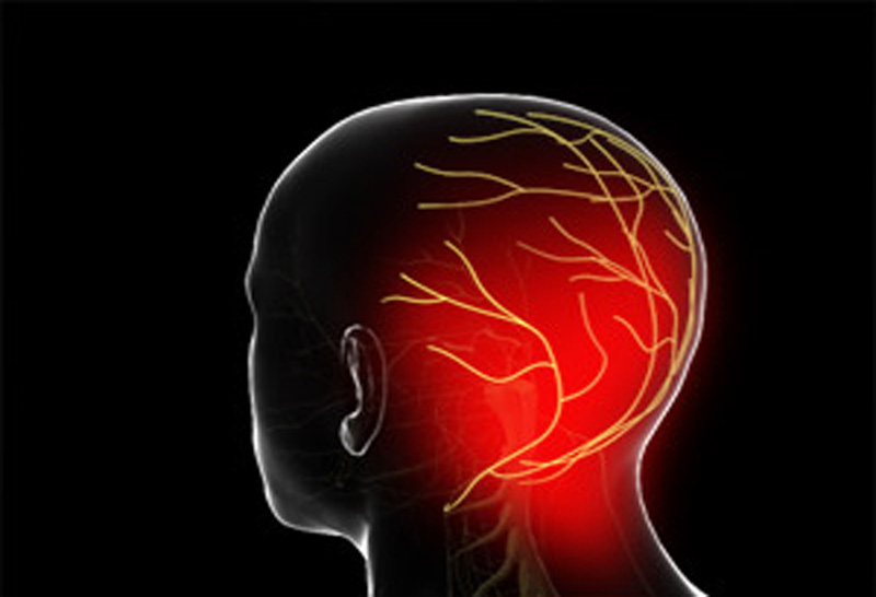 سردرد و گوش درد ناشی از اختلال عصب لسر اکسیپیتال و روش های مختلف درمان