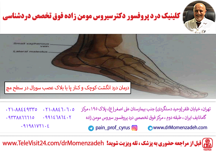 درمان درد انگشت کوچک و کنار پا با بلاک عصب سورال (Sural) در سطح مچ