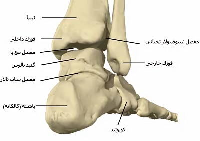 سندرم سینوس تارسی