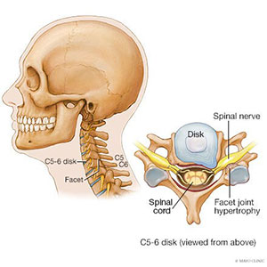 آناتومی مفاصل فست گردنی