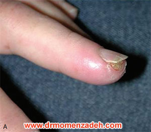 drMomenzadeh,پروفسور دکتر سیروس مومن زاده,  دکتر سیروس مومن زاده ,سیروس مومن زاده, پروفسور سیروس مومن زاده, درد شناسی, فوق تخصص, درمان درد, درد, لیزر درمانی, لیزرتراپی, ازن تراپی, اوزون درمانی, درد کمر, کمردرد, درد پا, درد گردن, گردن درد, درد دست, زانو درد, درد زانو,   مفاصل فست گردنی, ستون فقرات, آرتریت, پشت سر, ضعف سیستم ایمنی, گاید سونوگرافی,  درد حنجره, درد حنجره, درد دهان, عصب گلوسوفارنژیال, بلاک گانگلیون ستلایت, Stellate ganglion