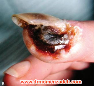 drMomenzadeh,پروفسور دکتر سیروس مومن زاده,  دکتر سیروس مومن زاده ,سیروس مومن زاده, پروفسور سیروس مومن زاده, درد شناسی, فوق تخصص, درمان درد, درد, لیزر درمانی, لیزرتراپی, ازن تراپی, اوزون درمانی, درد کمر, کمردرد, درد پا, درد گردن, گردن درد, درد دست, زانو درد, درد زانو,   مفاصل فست گردنی, ستون فقرات, آرتریت, پشت سر, ضعف سیستم ایمنی, گاید سونوگرافی,  درد حنجره, درد حنجره, درد دهان, عصب گلوسوفارنژیال, بلاک گانگلیون ستلایت, Stellate ganglion