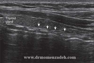 drMomenzadeh, پروفسور دکتر سیروس مومن زاده,  دکتر سیروس مومن زاده ,سیروس مومن زاده, پروفسور سیروس مومن زاده, درد شناسی, فوق تخصص, درمان درد, درد, لیزر درمانی, لیزرتراپی, ازن تراپی, اوزون درمانی, درد کمر, کمردرد, درد پا, درد گردن, گردن درد, درد دست, زانو درد, درد زانو, مفاصل فست گردنی, ستون فقرات, آرتریت, پشت سر, ضعف سیستم ایمنی, گاید سونوگرافی,  درد حنجره, درد حنجره, درد دهان, درد بازو, بلاک شبکه بازویی, فست گردن, درد کنار گردن تا قفسه سینه, مچ دست، درد آرنج, عصب راجعه حنجره