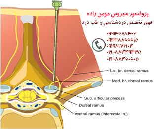 مفاصل فست سینه‌ای, پروفسور دکتر سیروس مومن زاده,  دکتر سیروس مومن زاده ,سیروس مومن زاده, پروفسور سیروس مومن زاده, درد شناسی, فوق تخصص, درمان درد, درد, لیزر درمانی, لیزرتراپی, ازن تراپی, اوزون درمانی, درد کمر, کمردرد, درد پا, درد گردن, گردن درد, درد دست, زانو درد, درد زانو, مفاصل فست گردنی, ستون فقرات, آرتریت, پشت سر, ضعف سیستم ایمنی, گاید سونوگرافی,  درد حنجره, درد حنجره, درد دهان, درد بازو, بلاک شبکه بازویی, فست گردن, درد کنار گردن تا قفسه سینه, مچ دست، درد آرنج, قفسه سینه