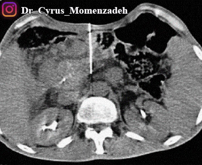 drCyrusMomenzadeh