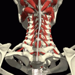 مدیریت دردهای مزمن: نورولیز ریشه خلفی گردن 