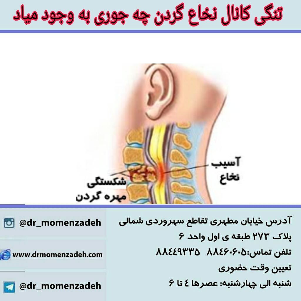 علائم تنگی كانال نخاعی گردن چیست؟