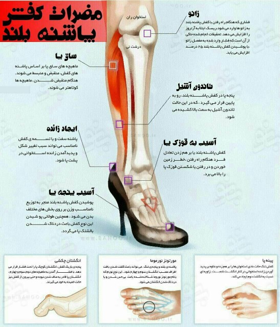 تاثیر_پاشنه_کفش_روی_بدن