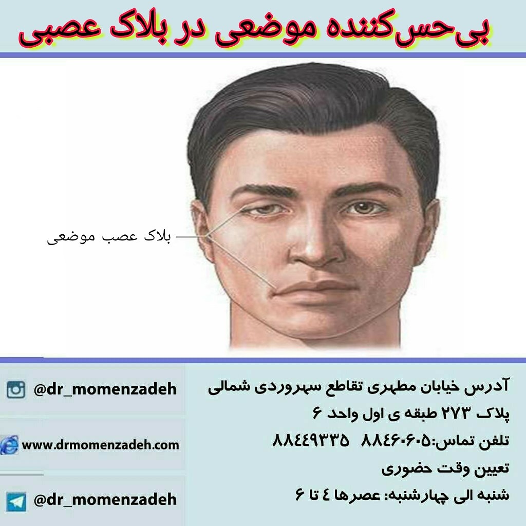 بی‌حس‌کننده موضعی در بلاک عصبی