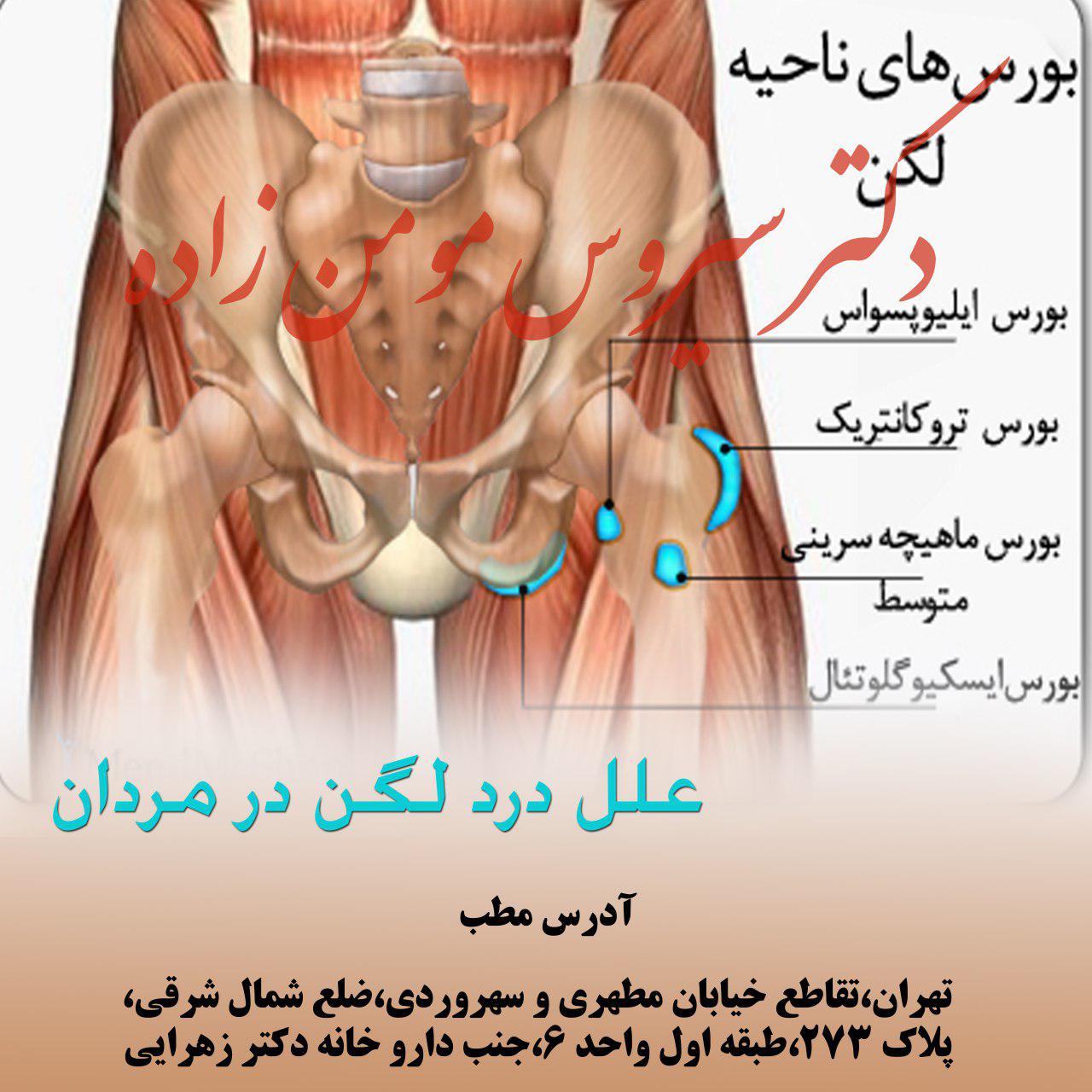 علل درد لگن در مردان