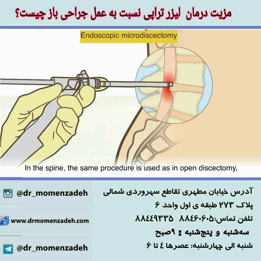 مزیت این روشها  نسبت به عمل جراحی باز چیست؟