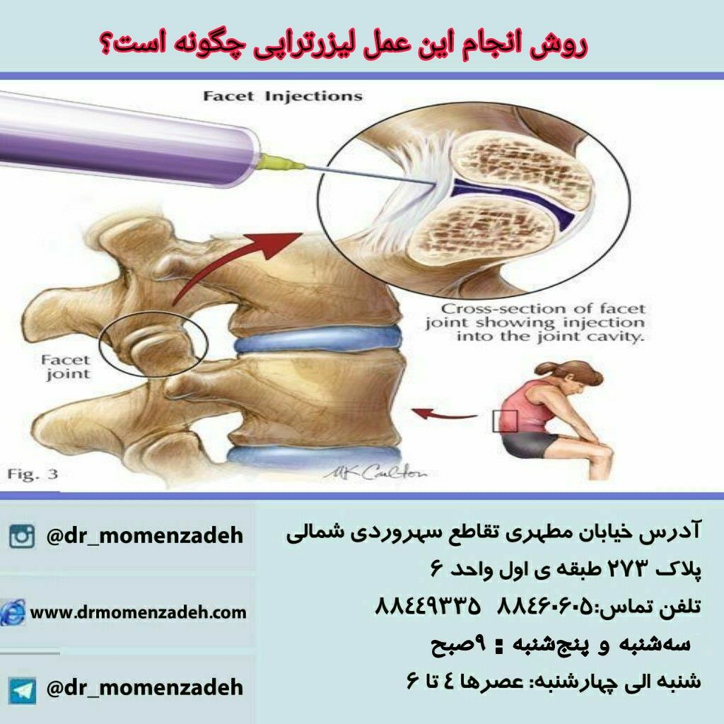 روش انجام این عمل چگونه است؟