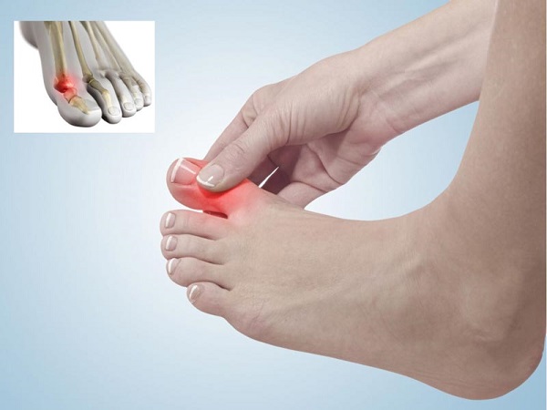 بررسی علل درد شست پا