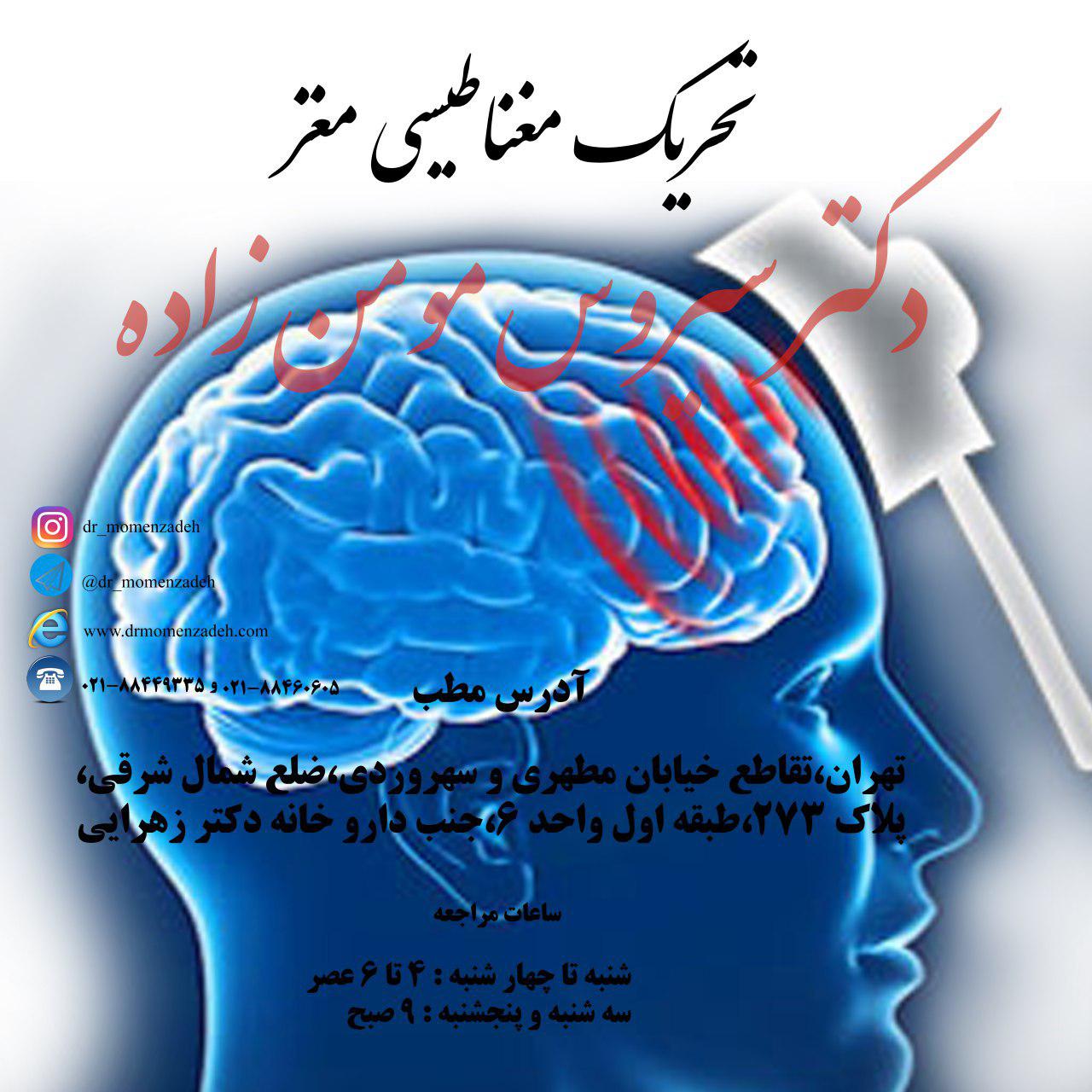 تحریک مغناطیسی مغز