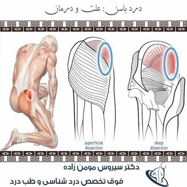 در پشت ران و باسن.