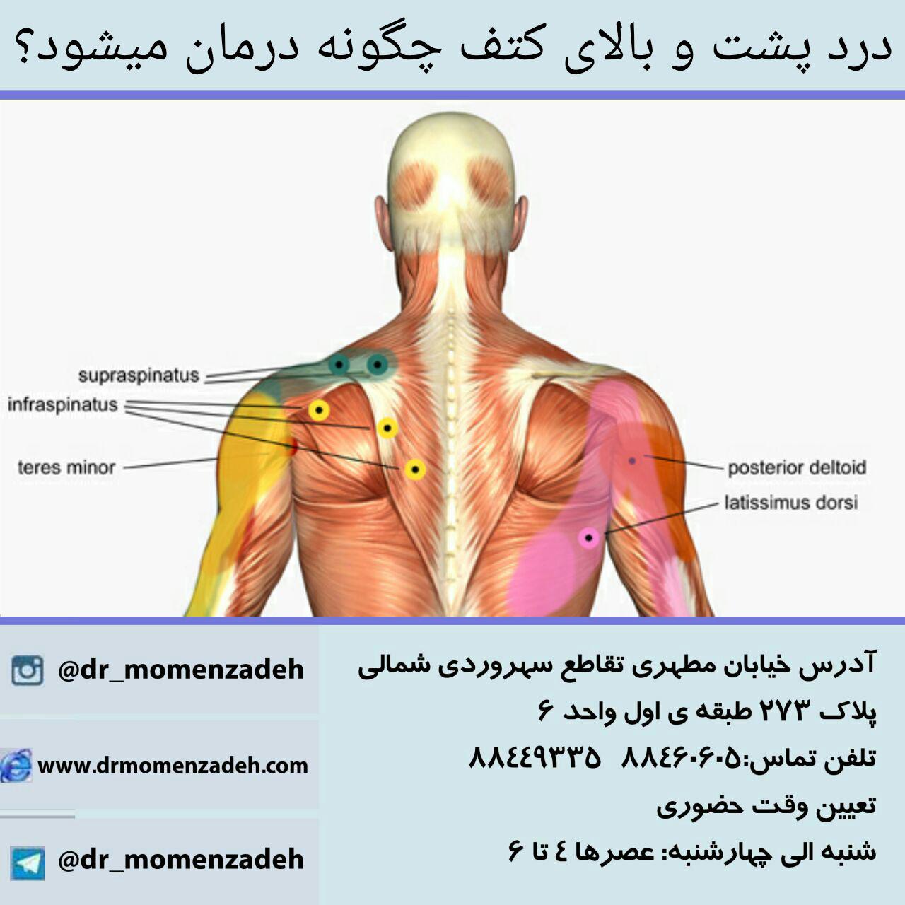 درمان سندرم درد مفاصل،درد پشت کتف و گردن