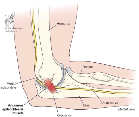 درد آرنج و سمت داخلی ساعد به دلیل التهاب عضله آنکونئوس اپی تروکلاریس و روش های مختلف درمان
