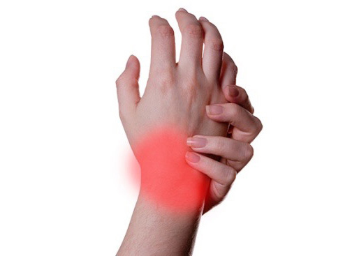 درد مچ دست ناشی از تندینیتیس فلکسور کارپی رادیالیس و روش های مختلف درمان