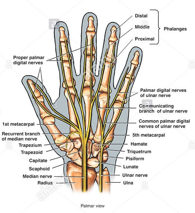 درد کف دست ناشی از اختلال عصب متاکارپال و روش های مختلف درمان