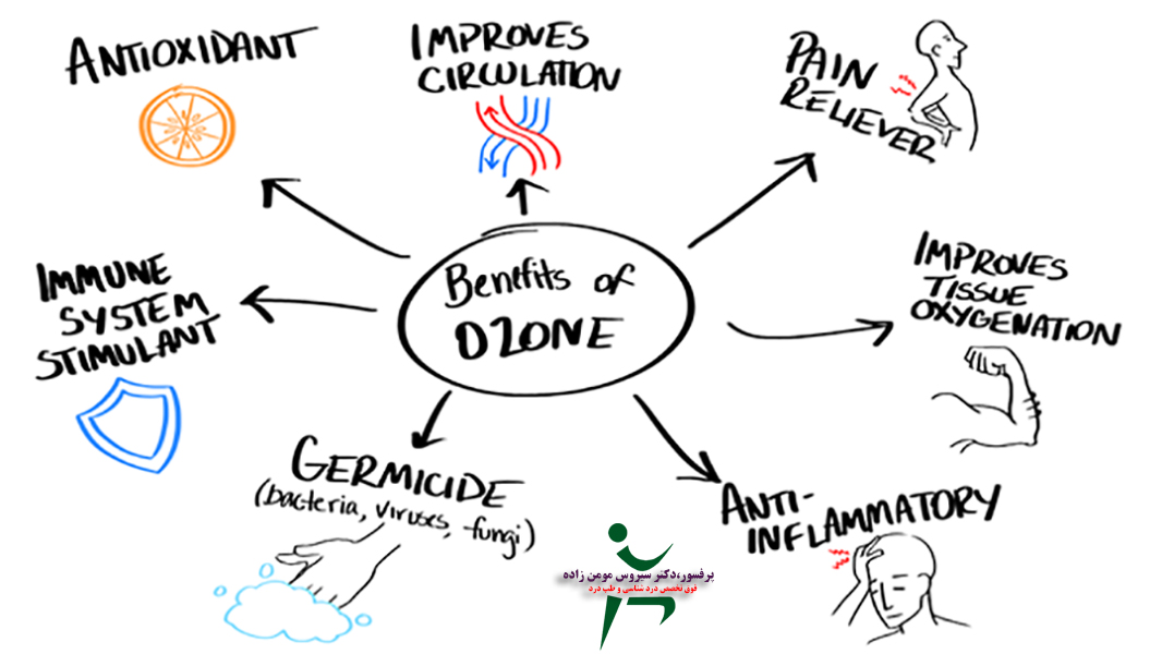 تزریق اوزون برای درمان انواع دردها