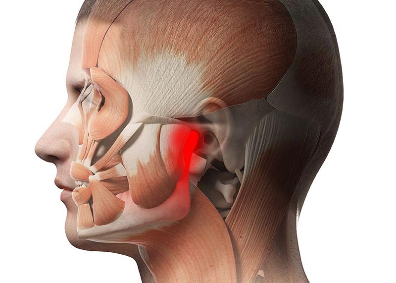 علت درد مفصل گیجگاهی و فکی - TMJ