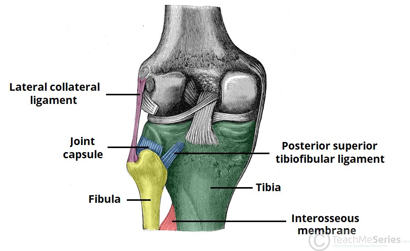 درد  زیر زانو ناشی از آرتریت مفصل تیبیوفیبولار و روش های مختلف درمان