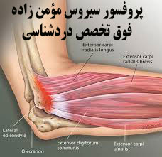 درد آرنج ناشی از سندروم آنکونئوس و روش های مختلف درمان