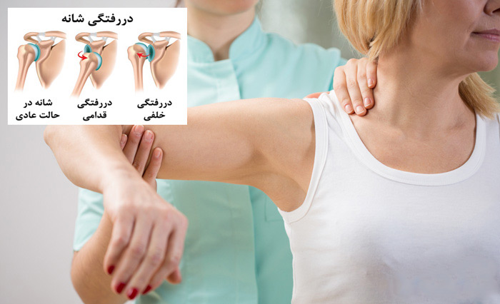 درمان در رفتگی مکرر مفصل شانه،کتف و بازو