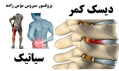 تفاوت دردهای دیسک کمر و درد سیاتیک