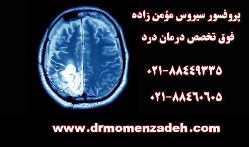 علائم تومور مغزی