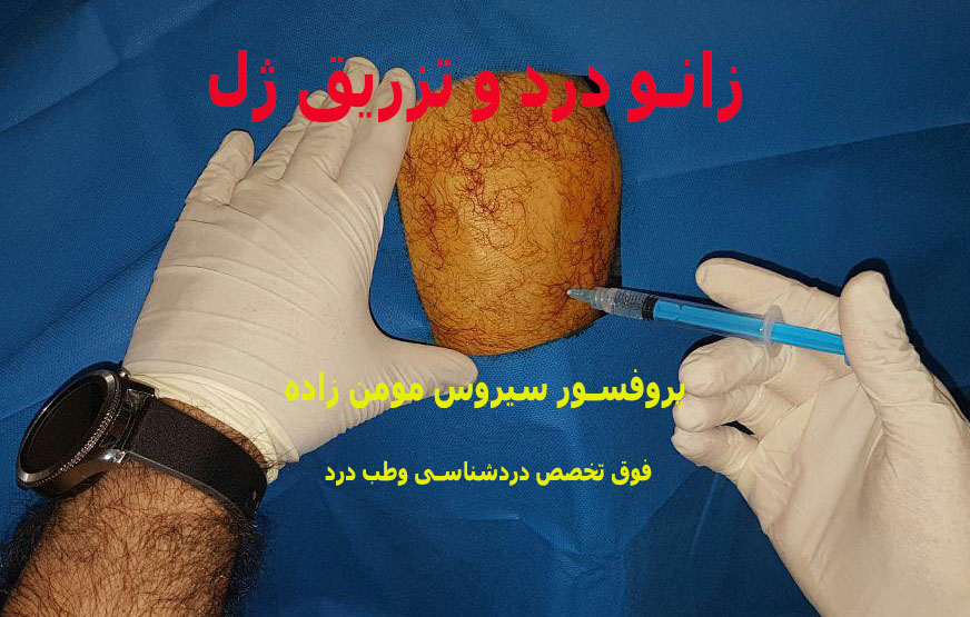 زانو درد و تزریق ژل