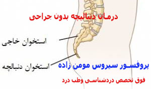 درمان دردنبالچه با روش‌های بدون جراحی