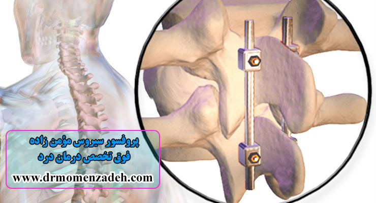 دلایل درد مهره‌های L5 و L4 ستون فقرات