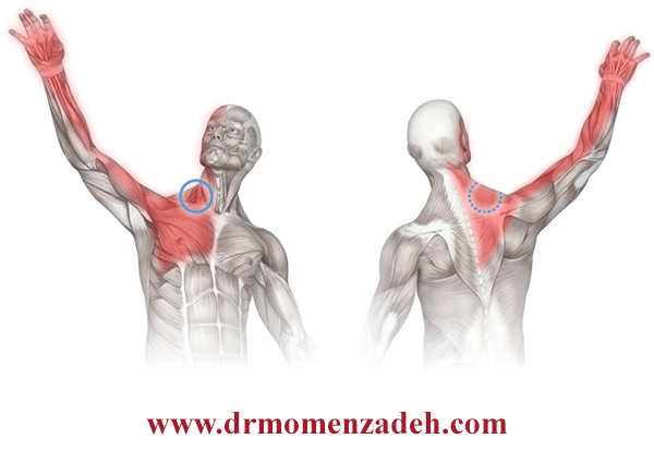 درمان و علل درد گردن و انتشار درد به دست