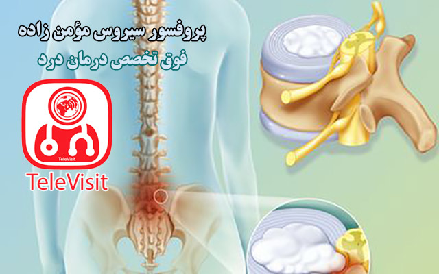 استفاده از لیزر در جراحی دیسک کمر