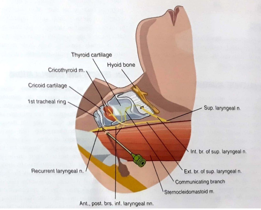 عصب راجعه حنجره