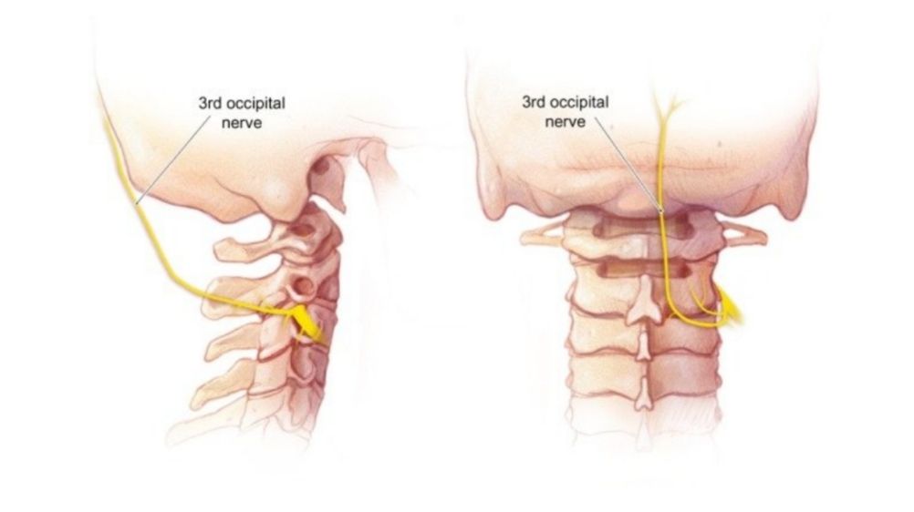 عصب اکسیپیتال سوم