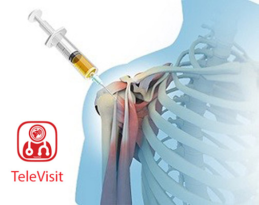 درمان درد شانه با پلاسمای غنی از پلاکت - PRP