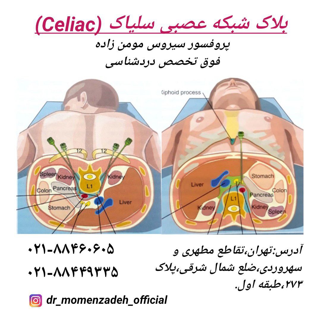 شبکه عصبی سلیاک