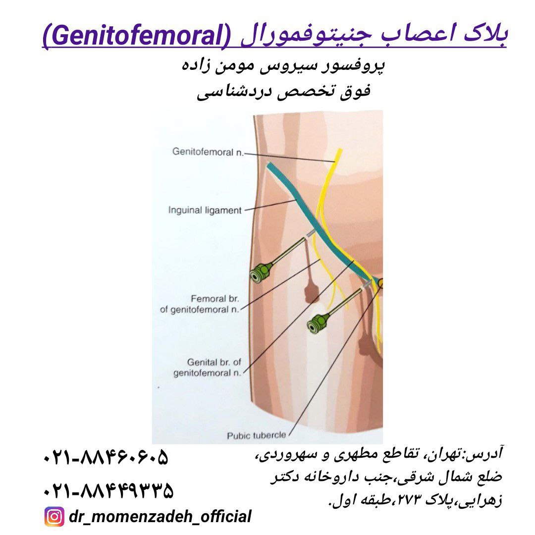 عصب جنیتوفمورال