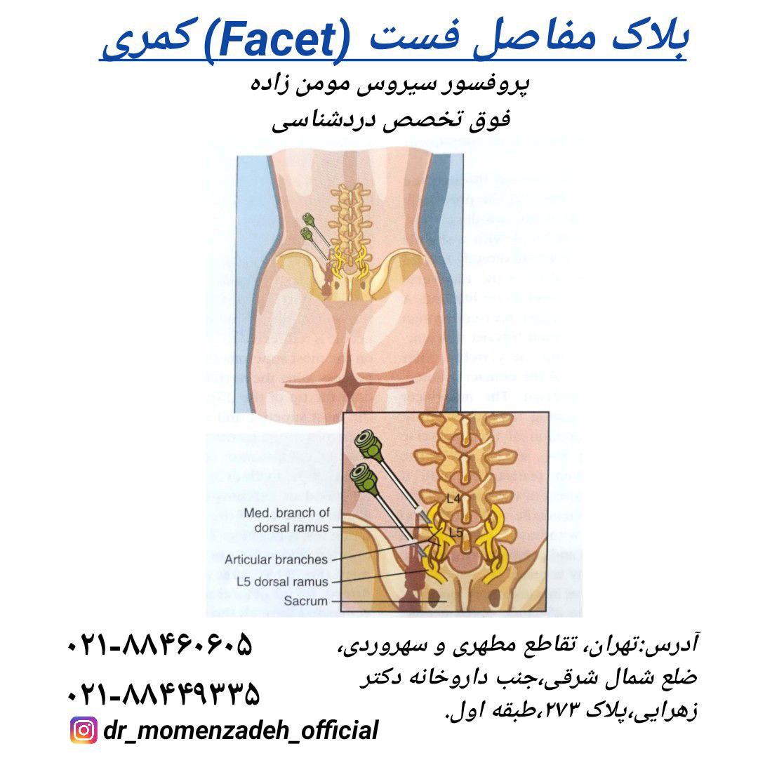 بلاک مفاصل فست (Facet) کمری