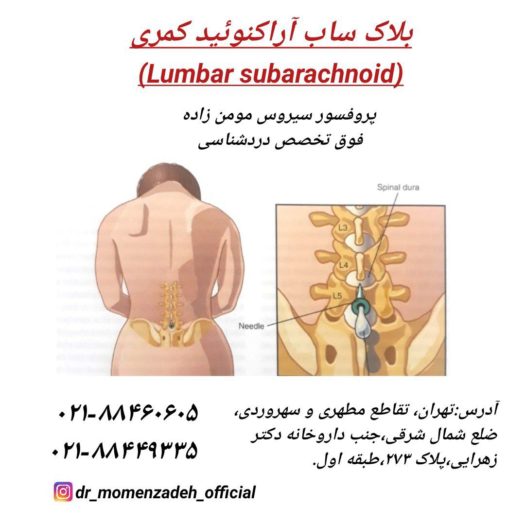 بلاک ساب آراکنوئید کمری