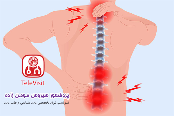 تنگی کانال نخاعی گردن و کمر