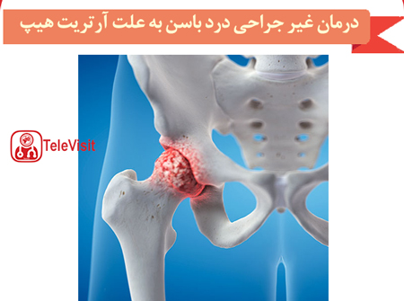 درمان درد باسن به علت آرتریت هیپ