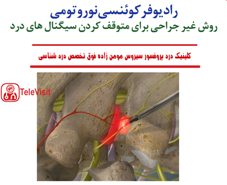 رادیوفرکوئنسی نوروتومی چیست و در چه مواردی استفاده می‌شود؟