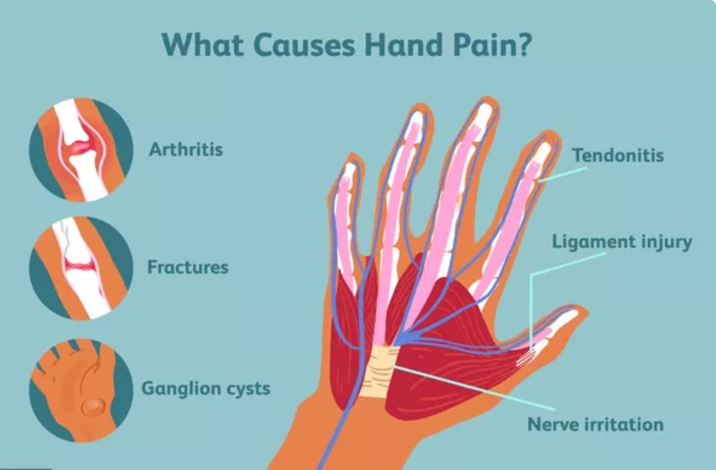 دلیل درد کف دست چیست و چه درمانی دارد؟