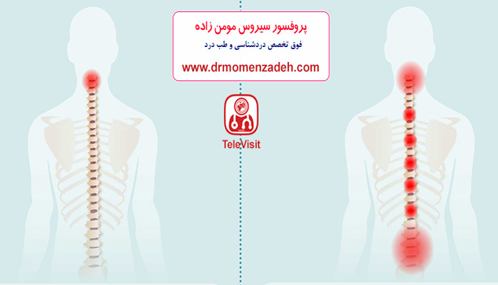 علائم، تشخیص و درمان کمر درد آرتریت روماتوئید