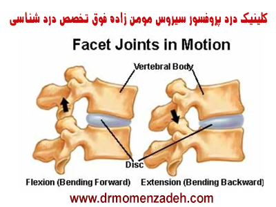 تفاوت درد دیسک با درد مفصل فاست چیست و چه درمانی دارد؟