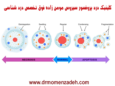 انواع و دلایل و درمان درد نکروز چیست؟